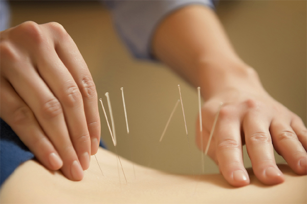 acupuncture courses